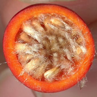 Hip - a cross section